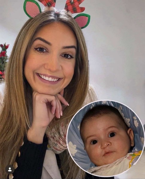 Psiholog Milica Alil Simović nasmejana, uz umetnutu fotografiju iz detinjstva – priča o životu sa rascepom usne i nepca.